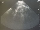 Scan Puppy 50 Days
